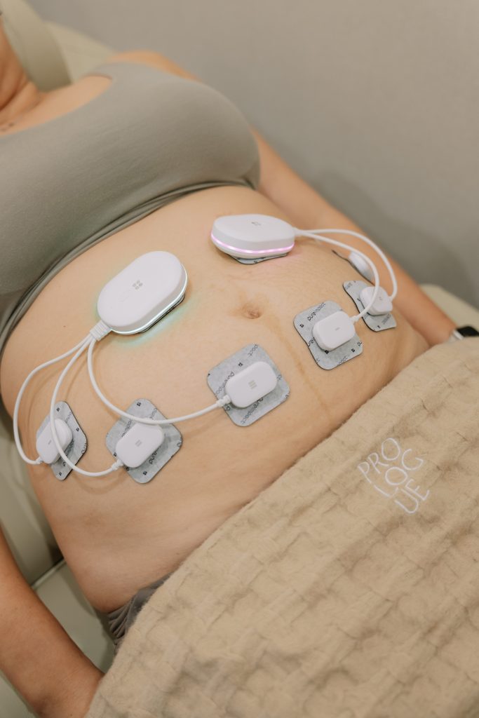 pure impact by sofwave for muscle toning treatment
