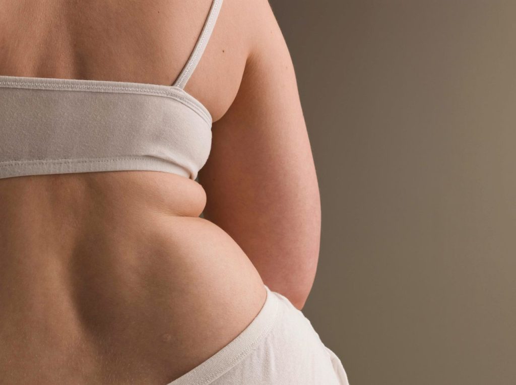 weight loss methods debunked by dietitian, Weight Loss Patches, Detox Teas