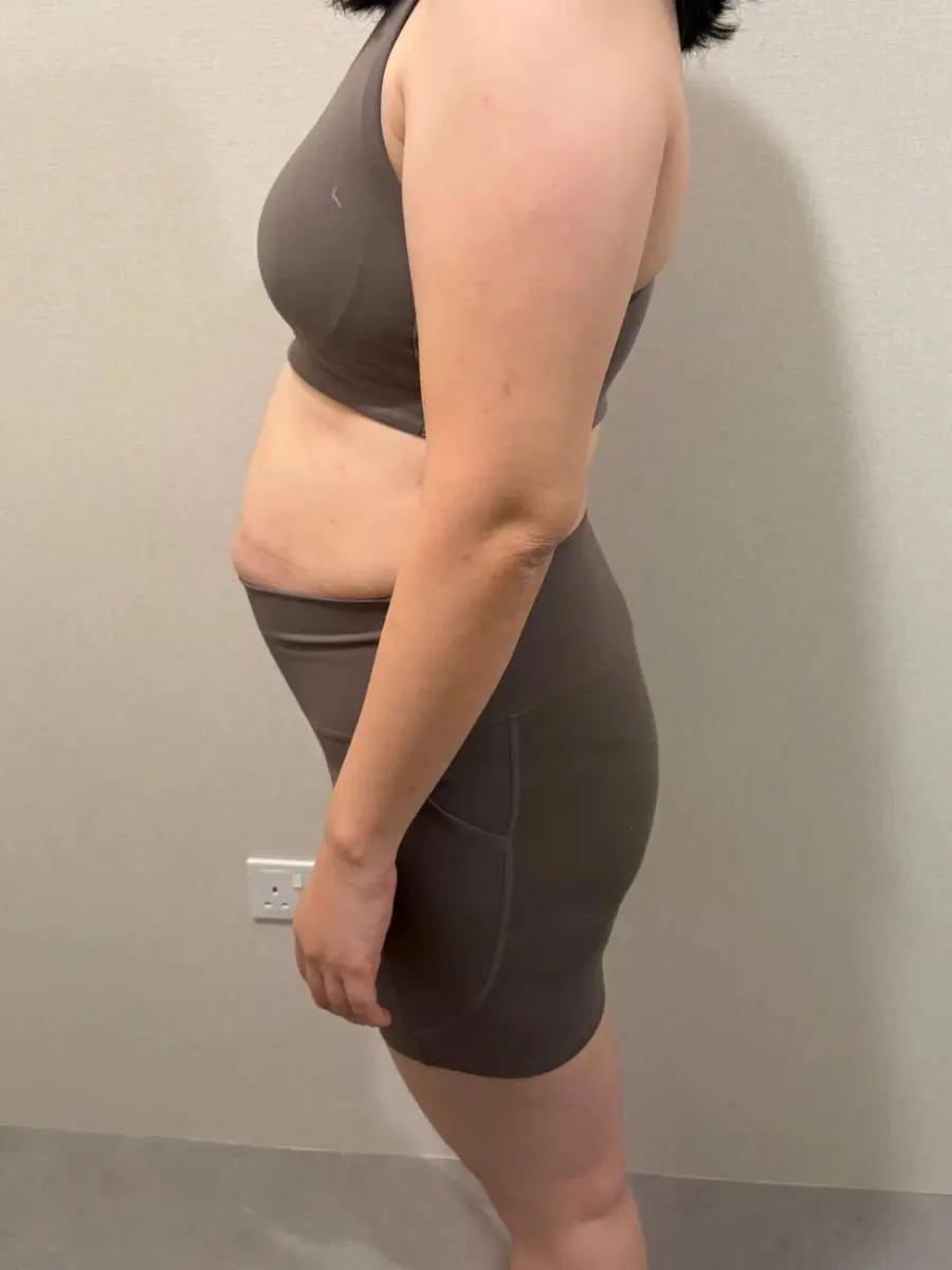 pww-ba1-before