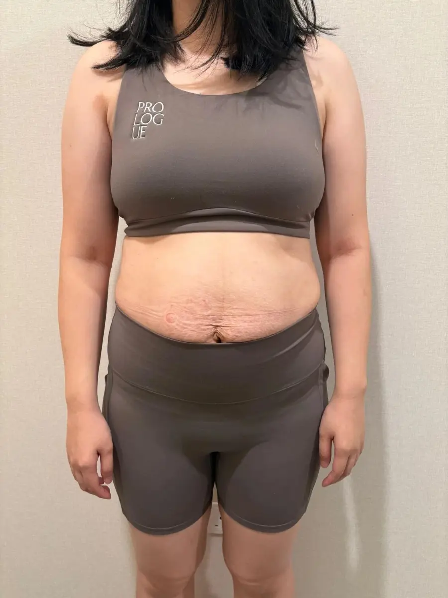 pww-ba2-before
