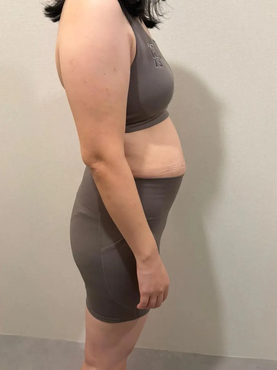 pww-ba3-before